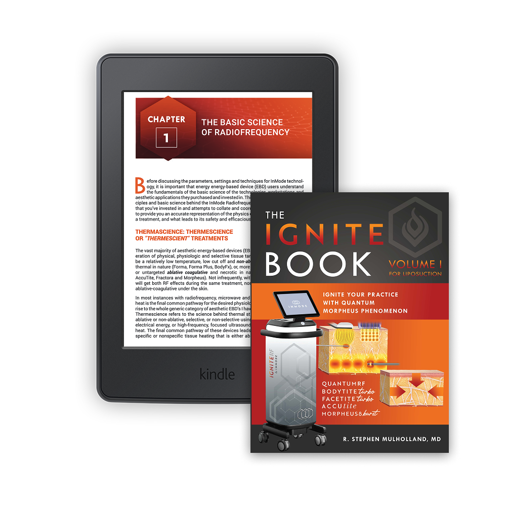 IgniteRF Kindle